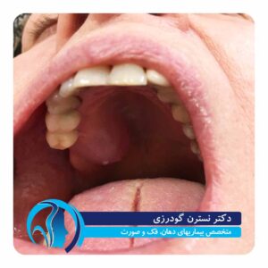 متخصص بیماریهای دهان و فک و صورت